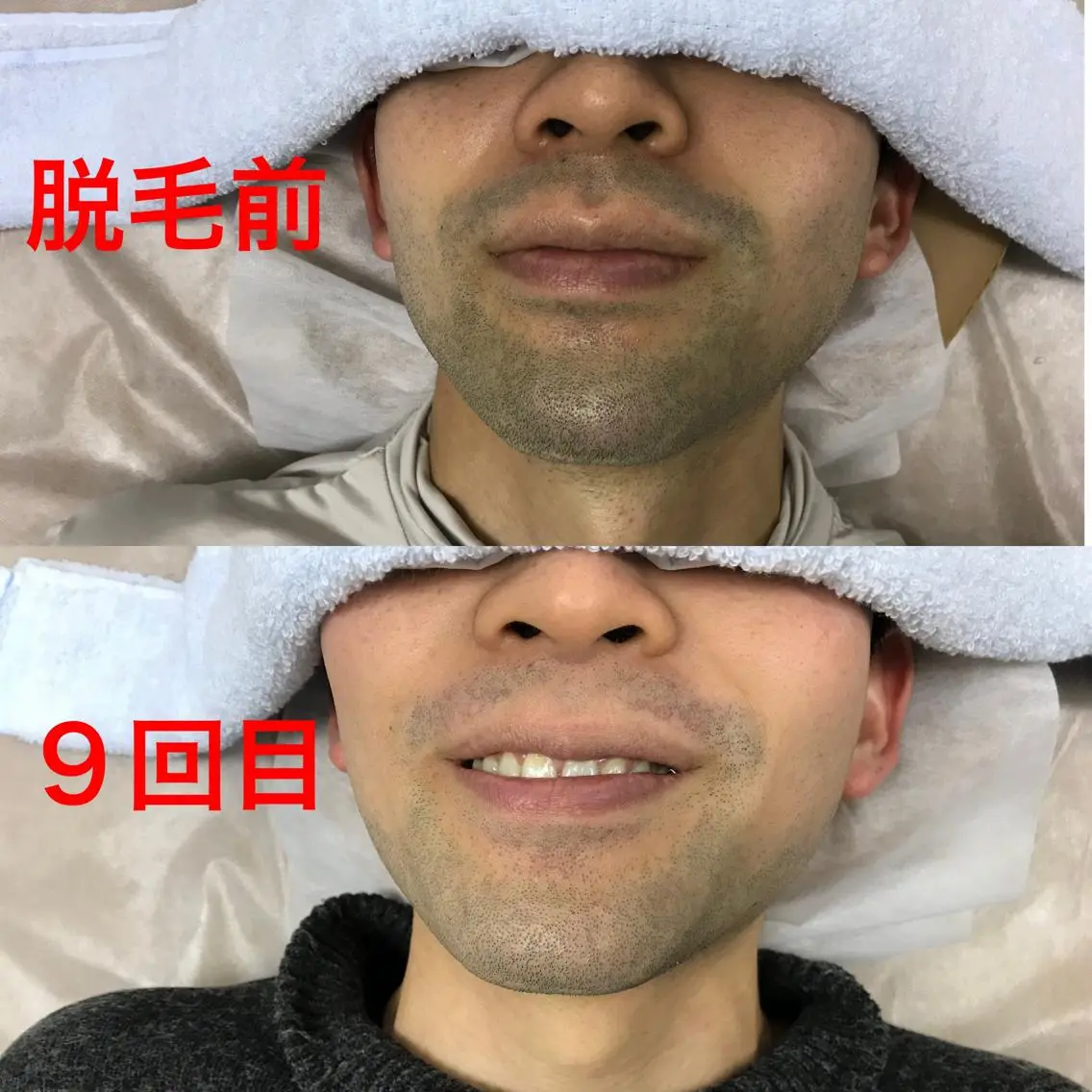 メンズ 脱毛 メンズ脱毛サロン /金山昌弘のエステ・リラクイメージ