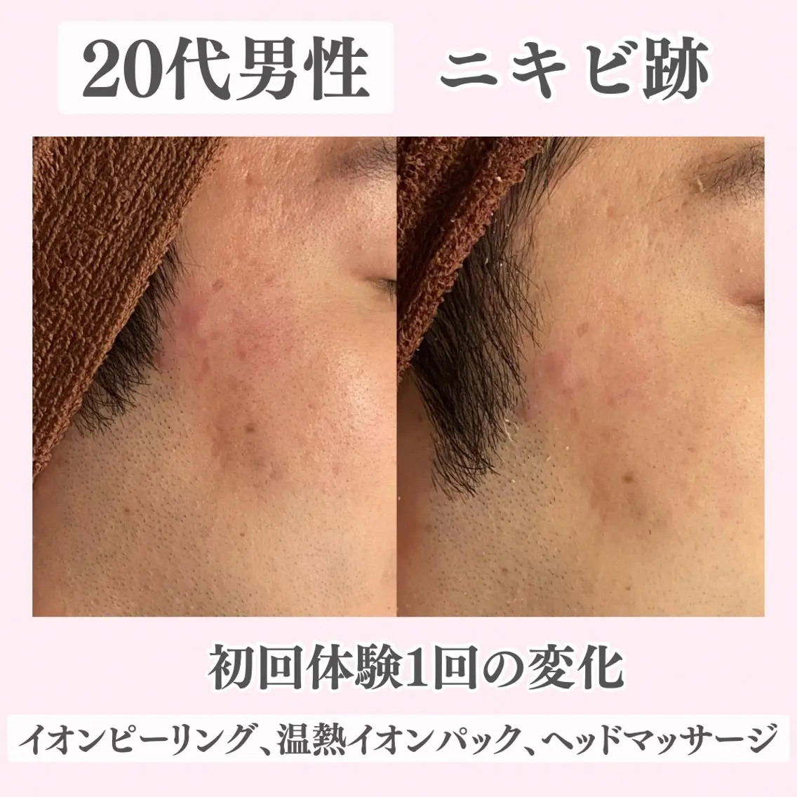 エステ リラク ニキビ・肌質改善専門 ♡人生が変わるサロンのエステ・リラクイメージ