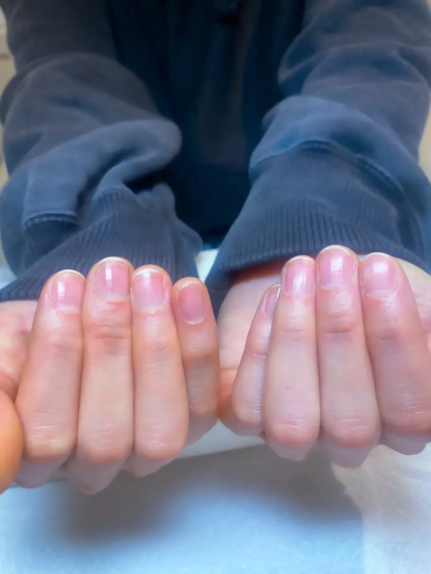 ナチュラル美爪ケアの写真