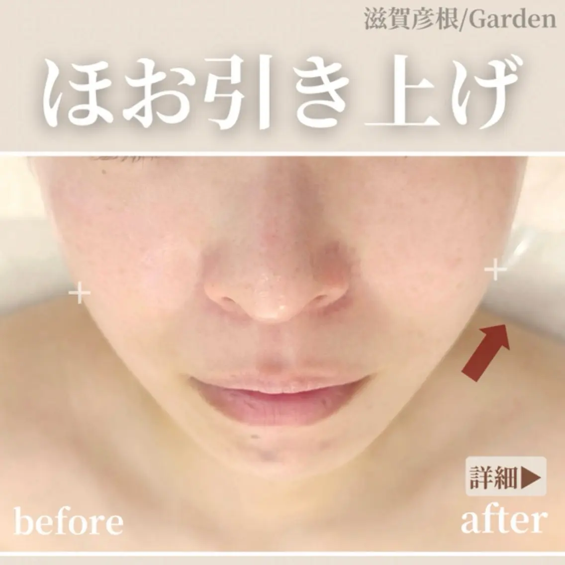 Garden こやまのエステ・リラクイメージ