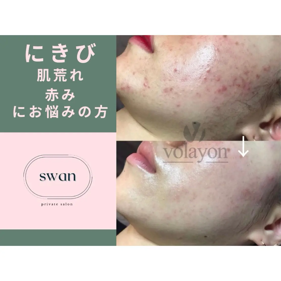 swan(スワン) 韓国肌管理 南堀江のエステ・リラクイメージ