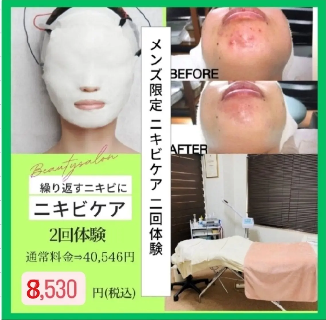 【平日限定🈹】《メンズ限定》ニキビ・ニキビ跡に◎ニキビケア2回体験✨(19歳以下不可)　[大阪城北詰駅/京橋駅]の写真