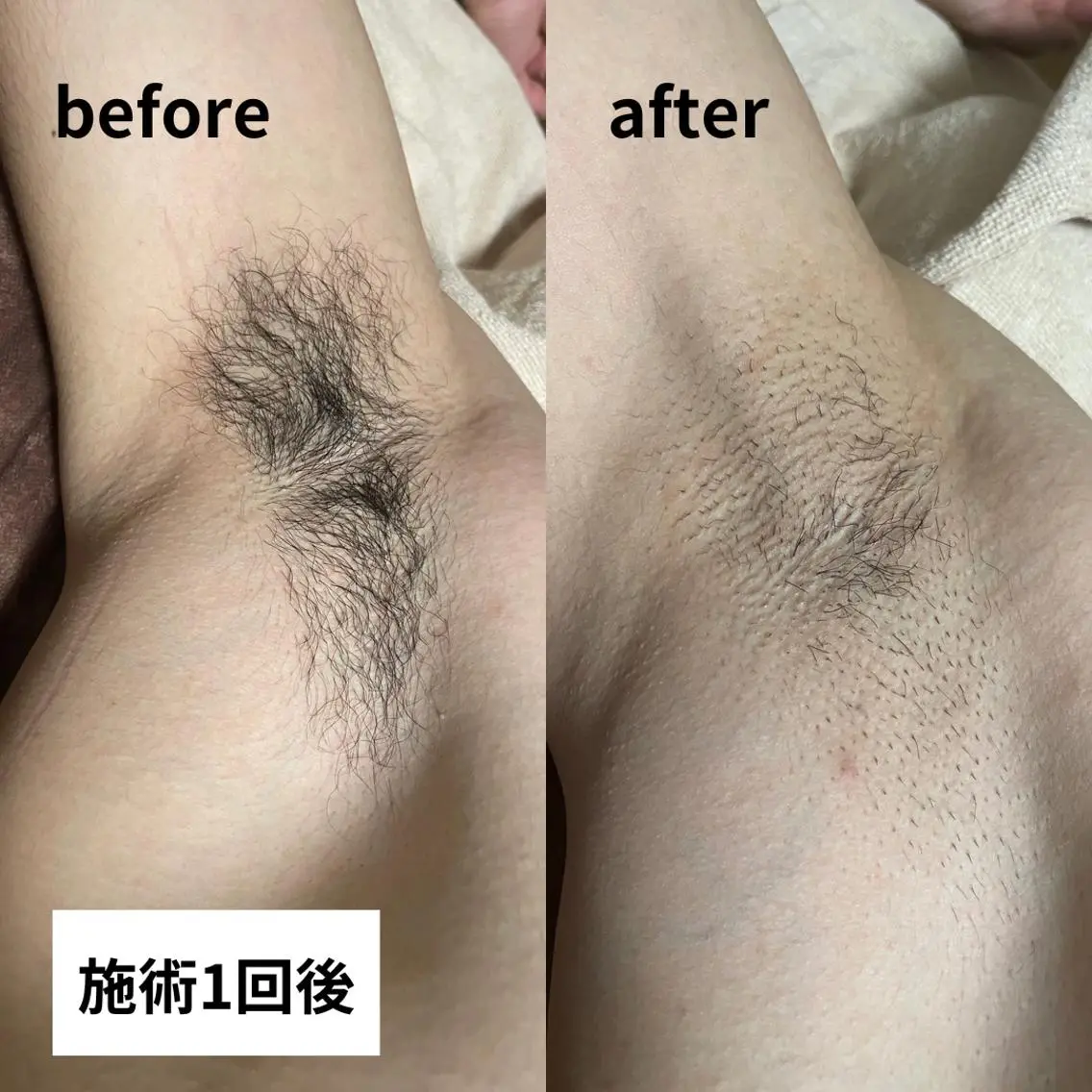 メンズ メンズ脱毛サロン 上岡　翼のエステ・リラクイメージ