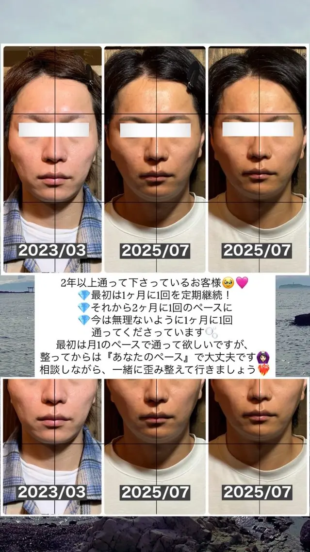 エステ リラク 💎後悔させない小顔 矯正💎イトヤマ🌱のエステ・リラクイメージ