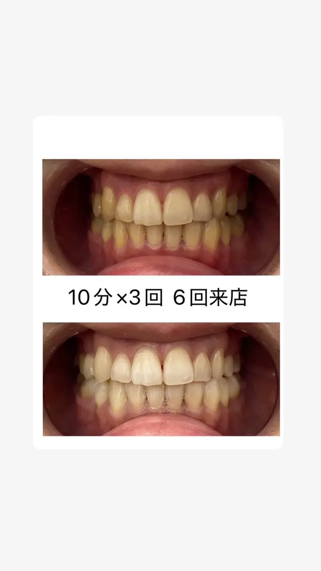 エステ ホワイトニングサロン スズキのエステ・リラクイメージ