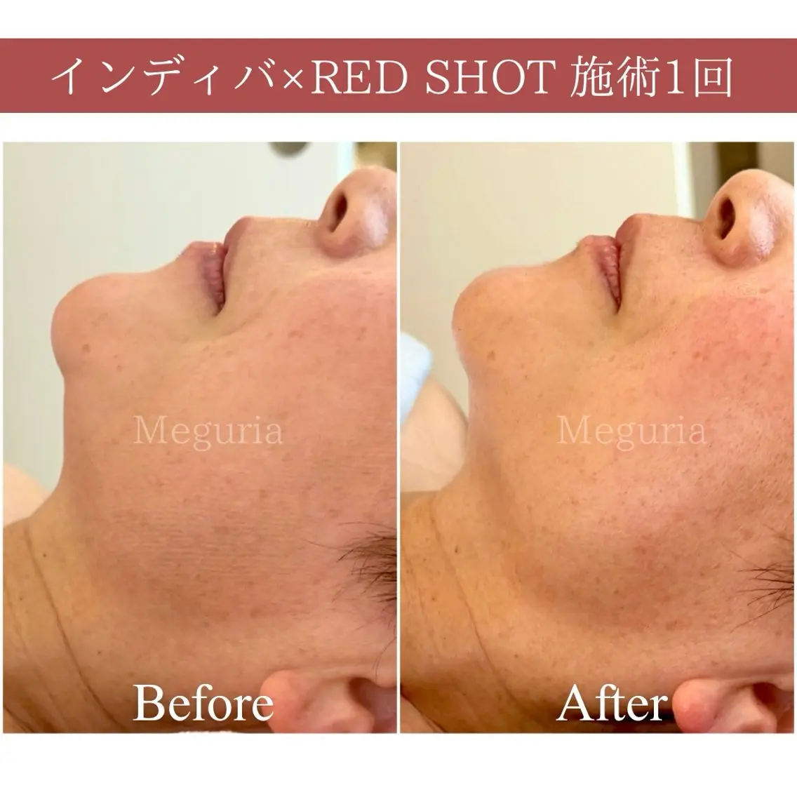 エステ Meguria 自由が丘のエステ・リラクイメージ