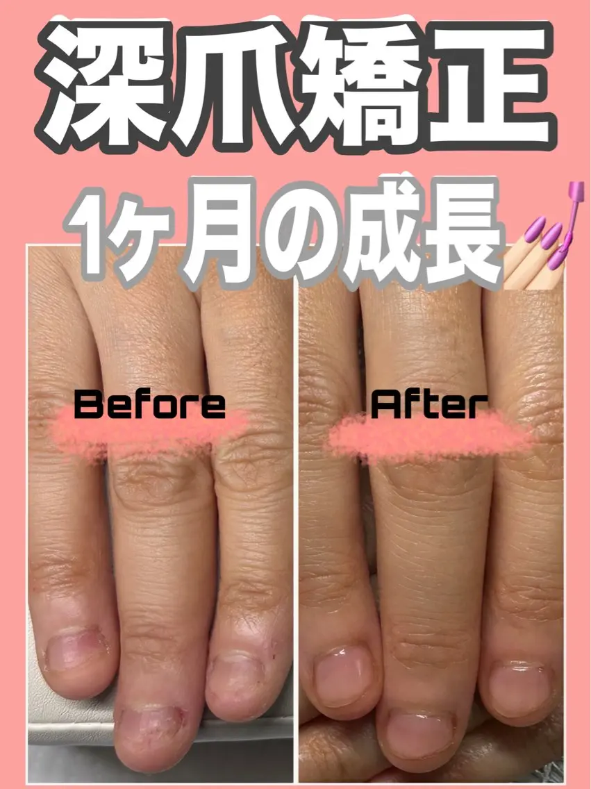 ネイル nail salon petillantのネイルデザイン