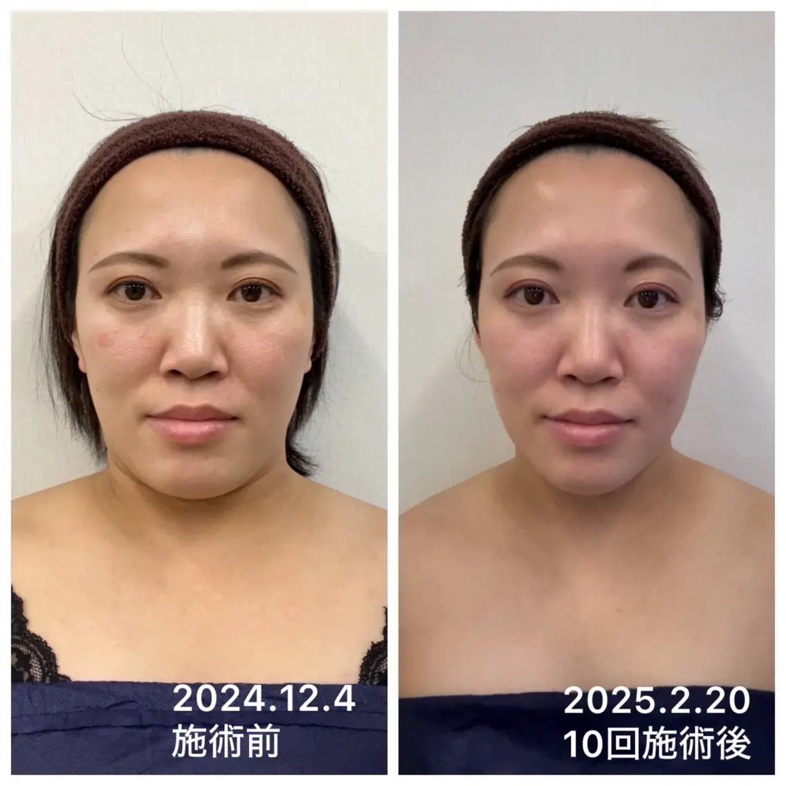 エステ 本物志向サロンTR ANSBEAUTYのエステ・リラクイメージ