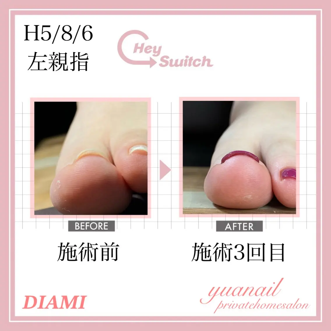 ネイル YÜA NAILのネイルデザイン