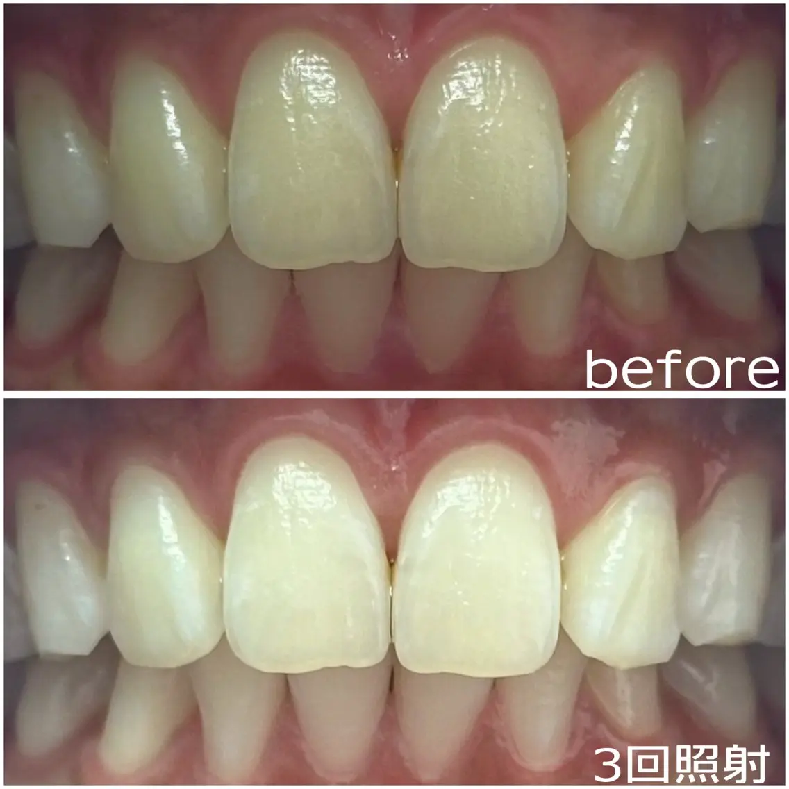 その他 White base ホワイトニングサロンのその他イメージ