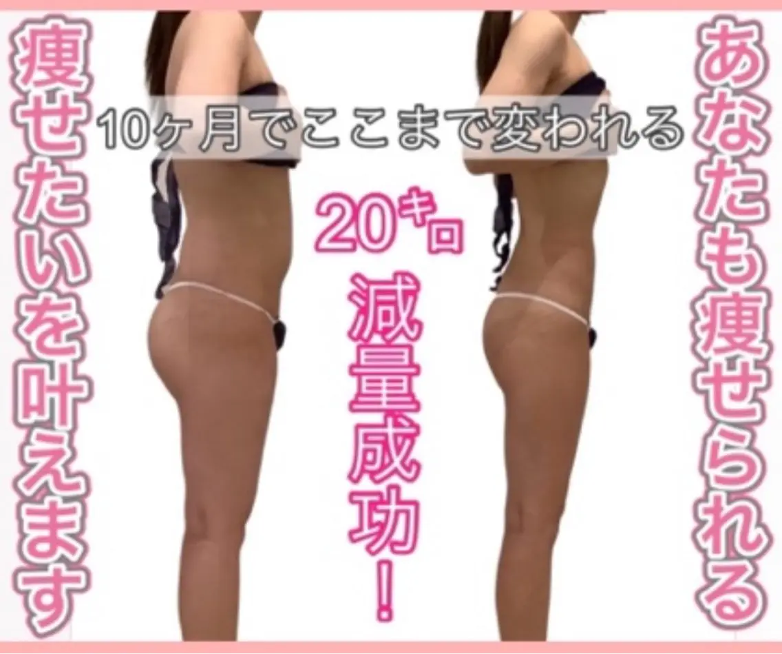 痩身ダイエット&小顔 🩷アールズスリムのエステ・リラクイメージ
