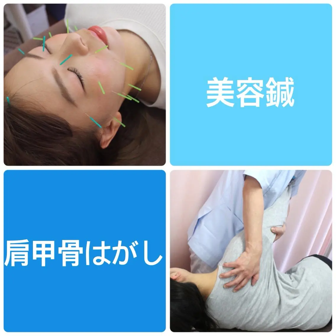 【 美容鍼 + 肩こり姿勢改善整体 】(目元、肩こりもスッキリ)カウンセリング付 70分 ¥9,000→¥4,800の写真
