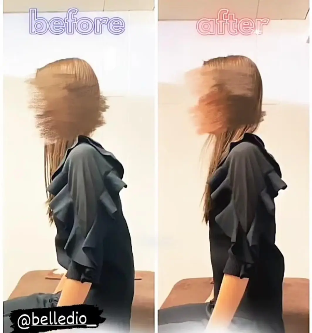 🌸顔+体の全身調整🌸姿勢矯正+美容鍼の写真