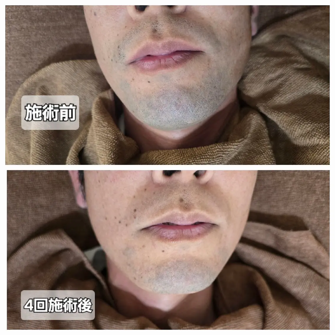 脱毛 Beauty&Epi Lysのエステ・リラクイメージ