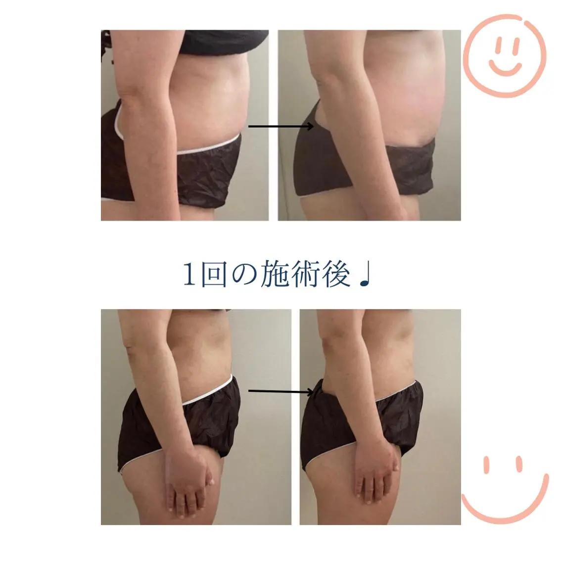 リラク リンパドレナージュ＆ 産前産後サロンSheのエステ・リラクイメージ