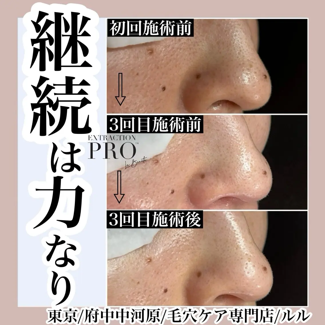 エステ LULU ルルのエステ・リラクイメージ