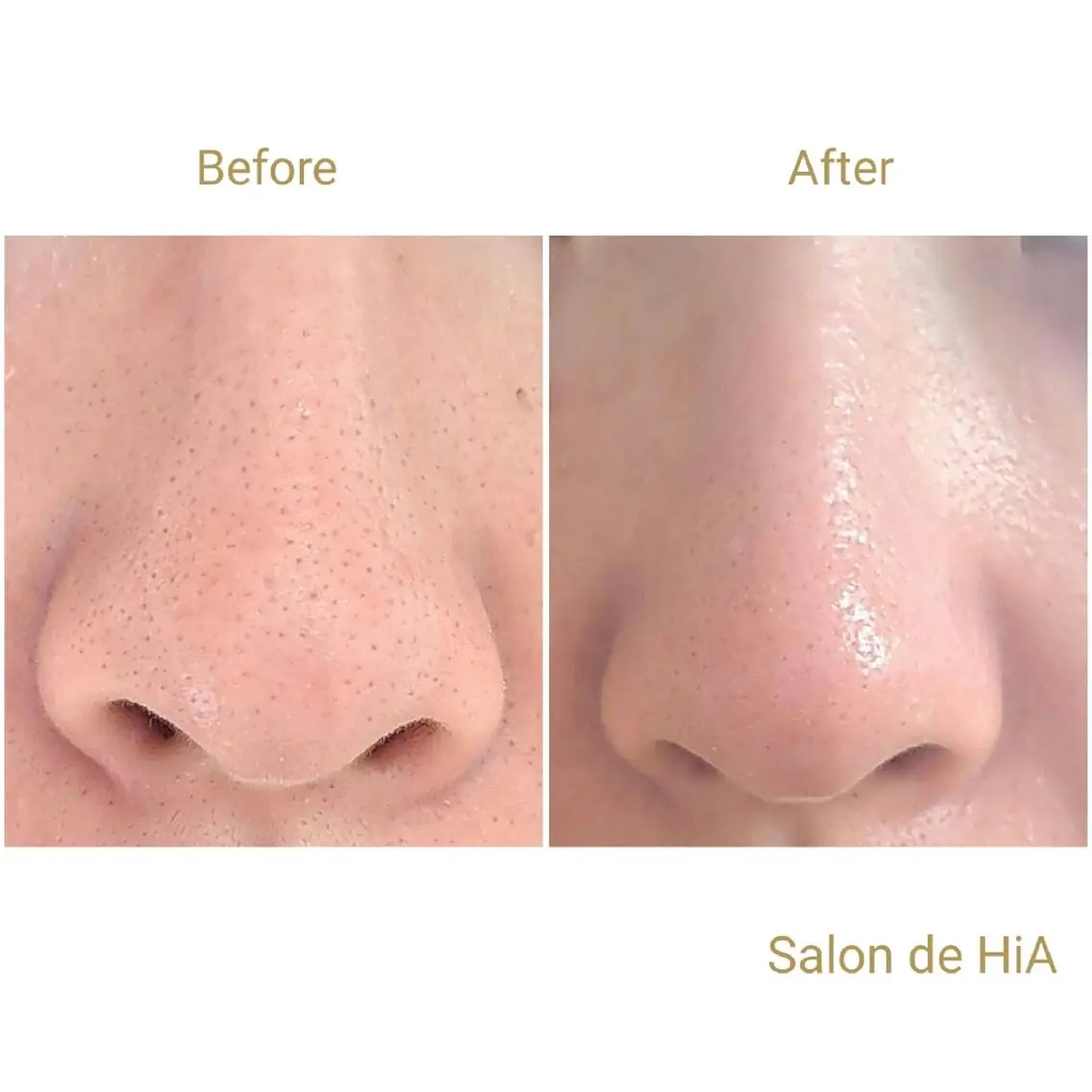 エステ Salon de  HiAのエステ・リラクイメージ