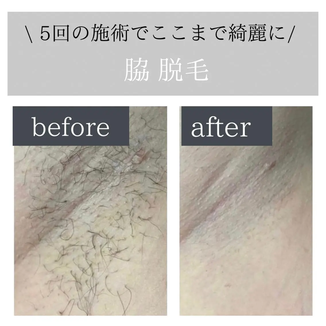 脱毛サロン Lokahiのエステ・リラクイメージ