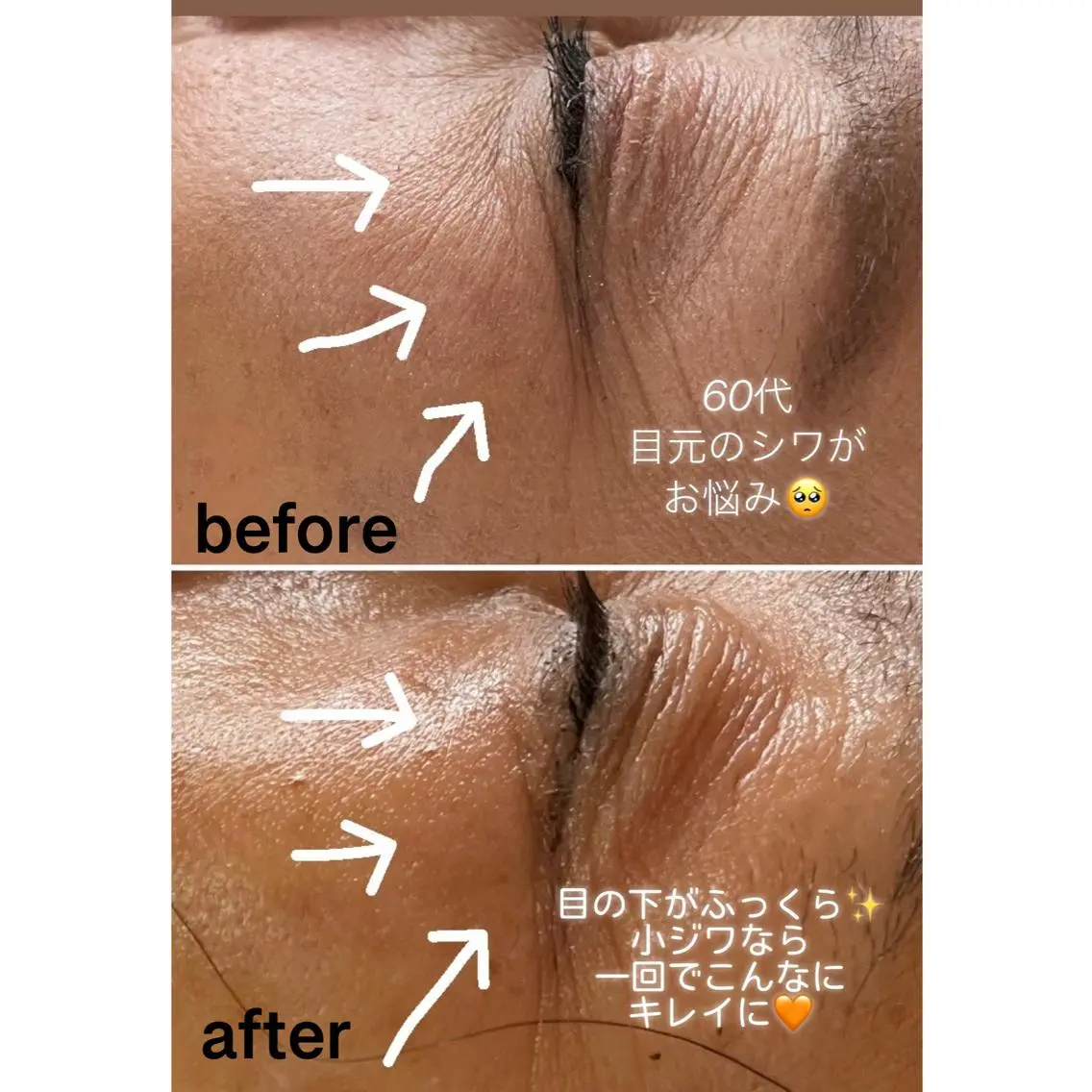 アロマ•ピーリング SalonYokoのその他イメージ