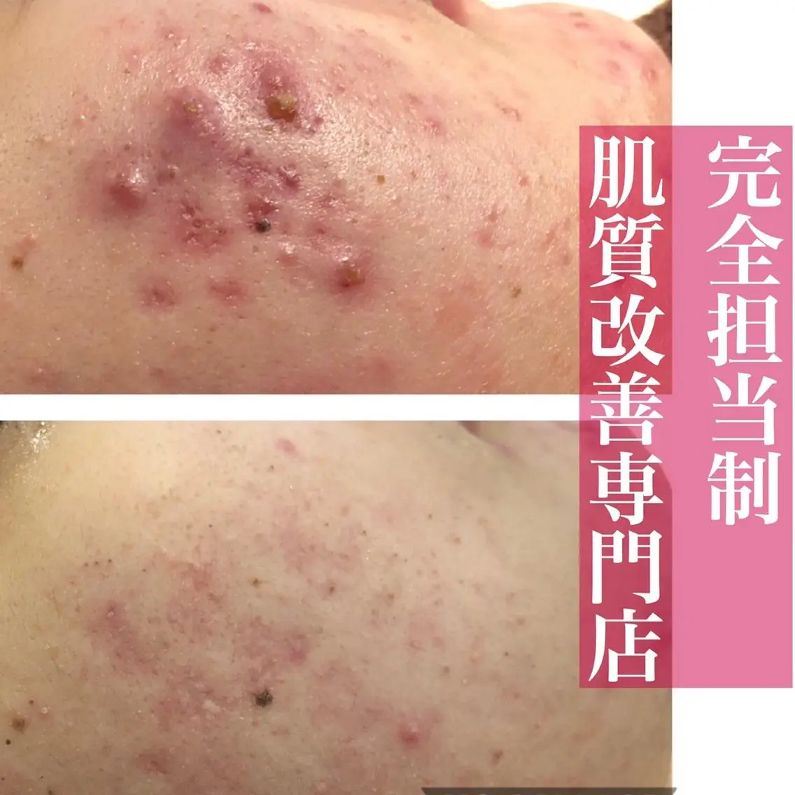 ミディアム カラー パーマ ヘアアレンジ メンズ キッズ ネイル マツエク・マツパ 赤色 エステ リラク ニキビ・肌質改善専門 ♡人生が変わるサロンのエステ・リラクイメージ