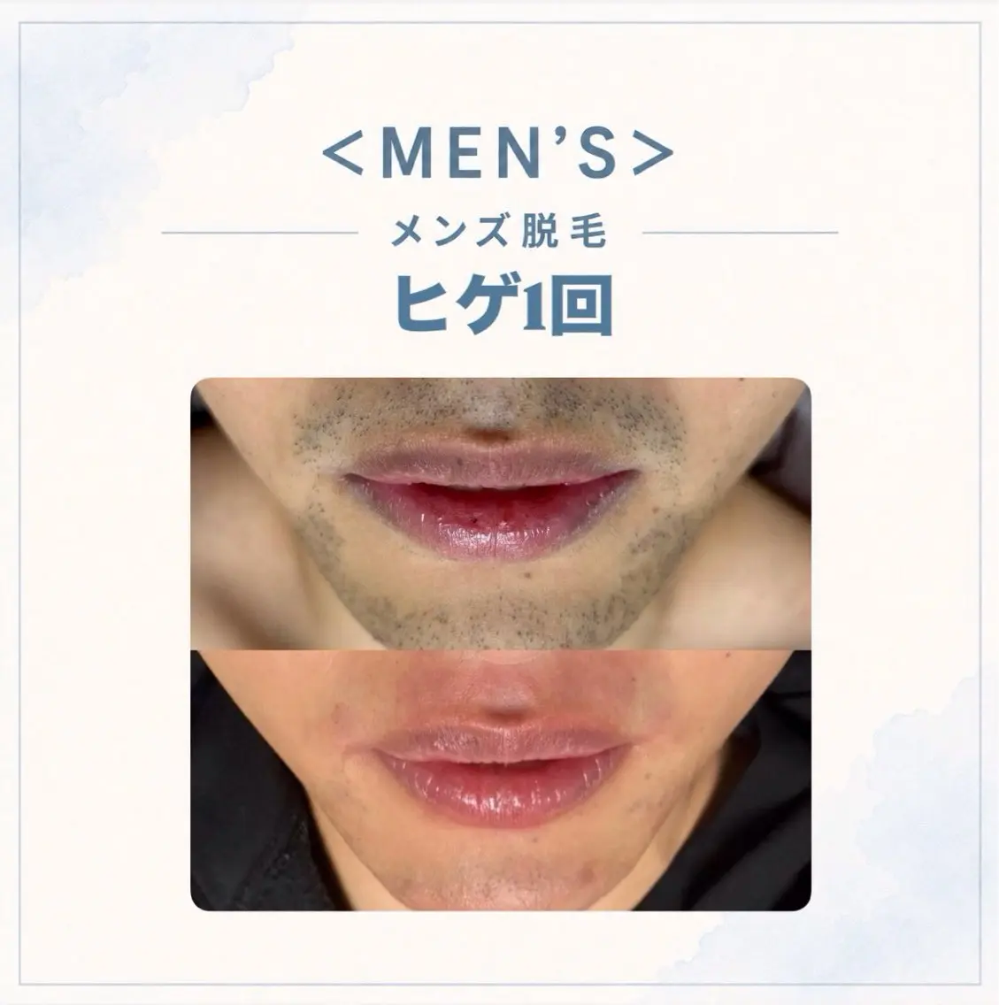 メディカルエステ マドンナ富士宮店のエステ・リラクイメージ