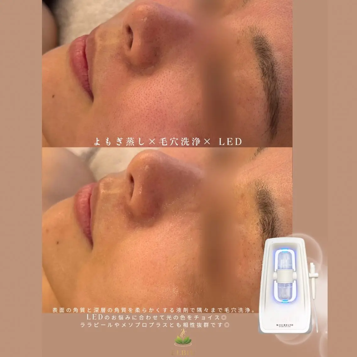 【内外から整える美肌ケア】黄土よもぎ蒸し40分+毛穴洗浄+LEDの写真