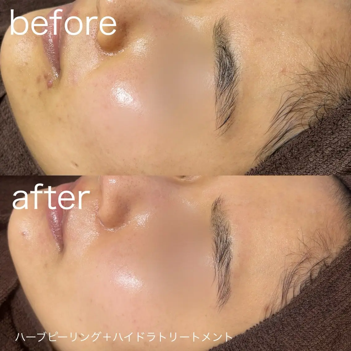 脱毛 lulularico Yuのネイルデザイン