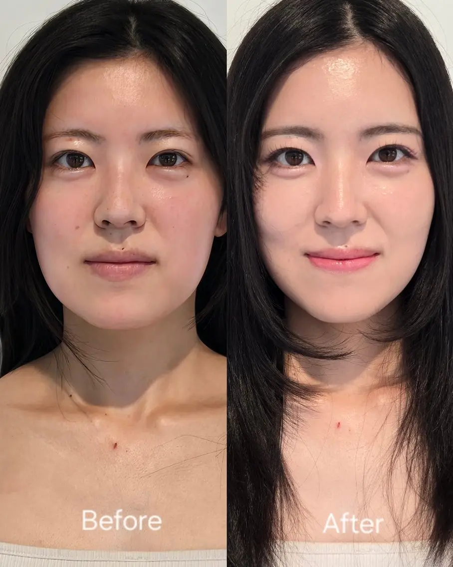 Hirali 韓国メイク🇰🇷のその他イメージ