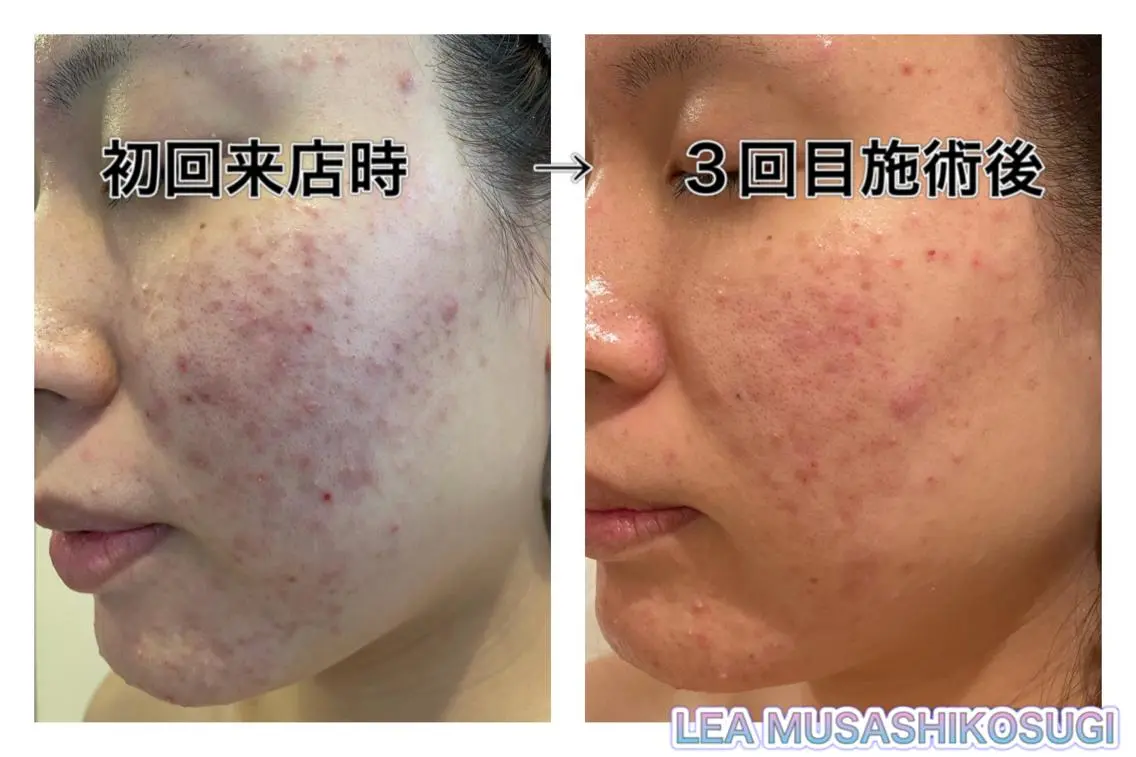 美肌育成サロン LEA武蔵小杉のエステ・リラクイメージ