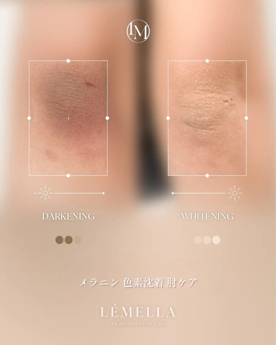 その他 水永 美咲のエステ・リラクイメージ