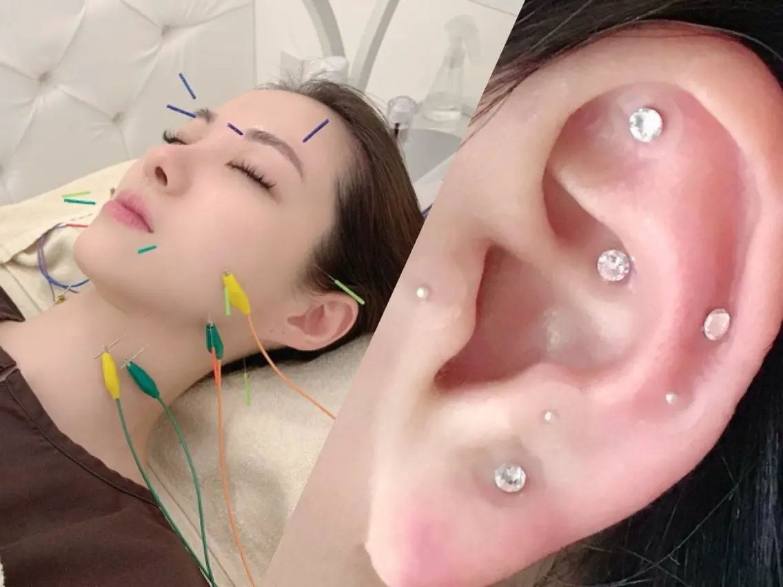 美容鍼灸院 acumond宮益坂のエステ・リラクイメージ