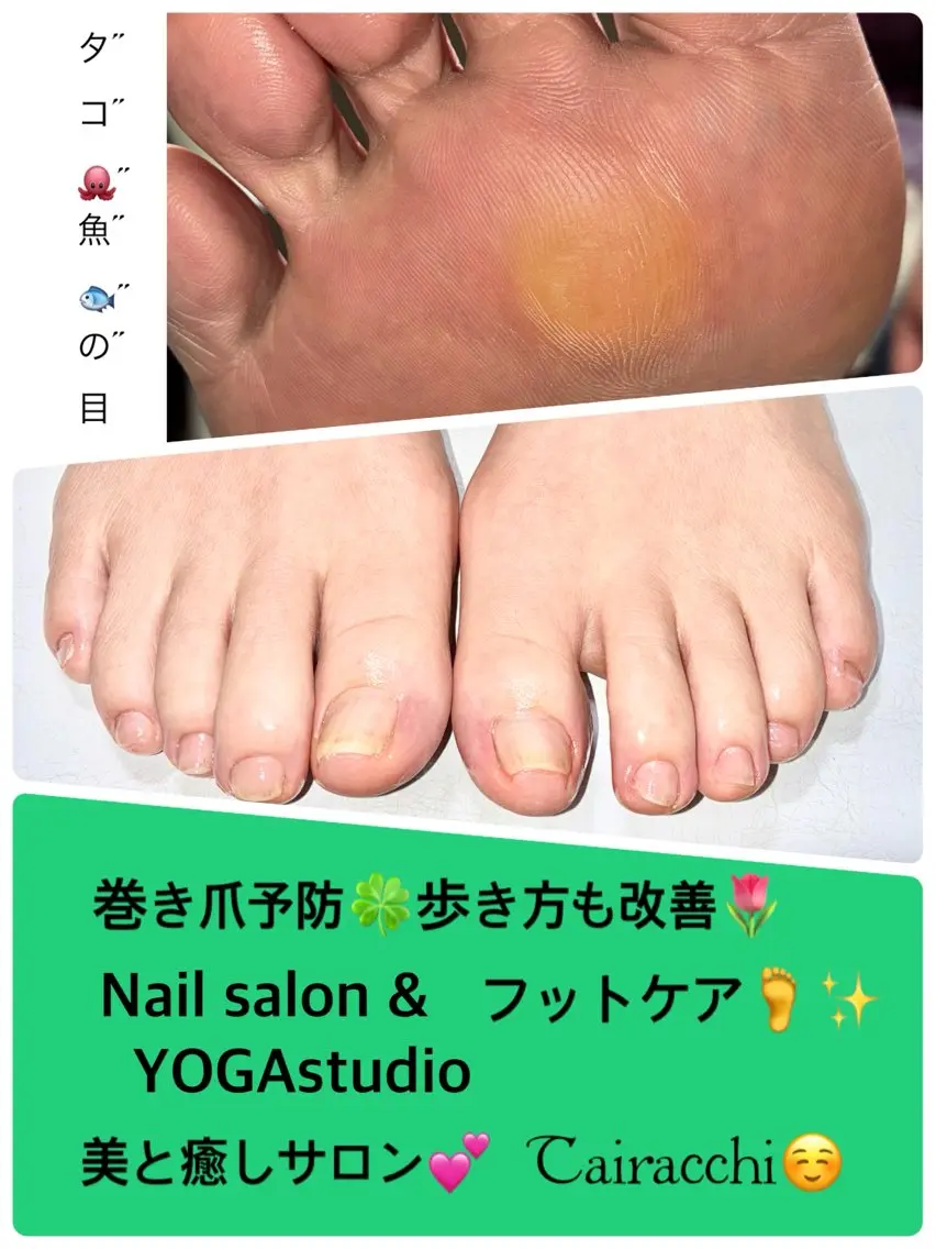 ネイル フットネイル フットネイル Tairacchi タイラッチのエステ・リラクイメージ