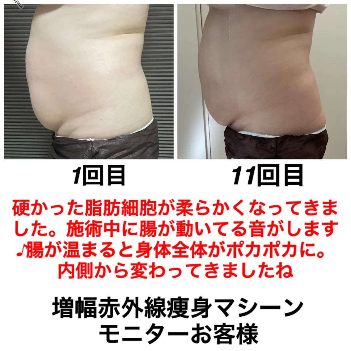 ネイル・エステサロン UILANIのエステ・リラクイメージ
