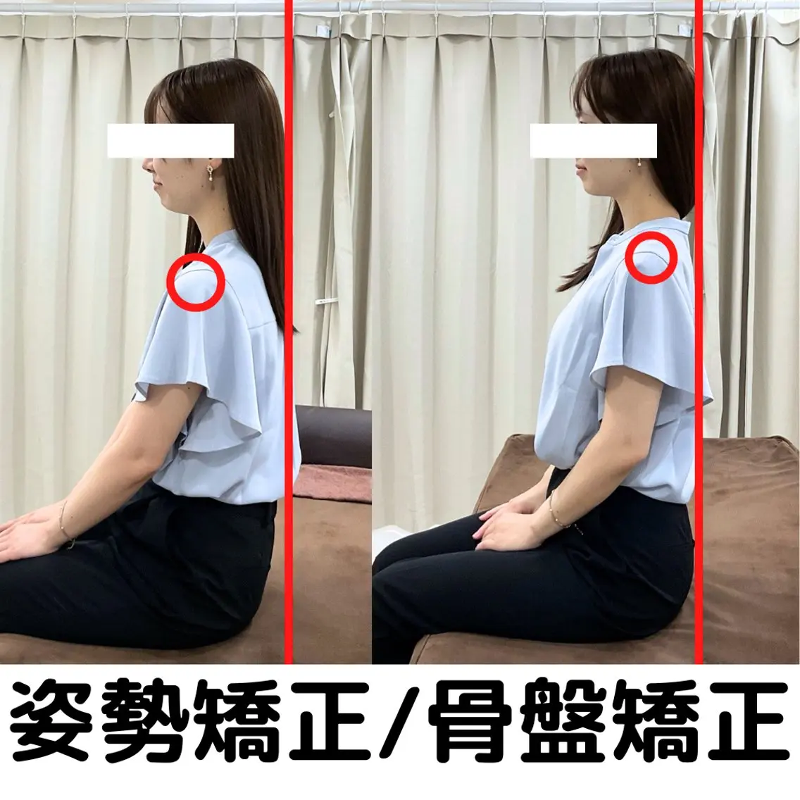 リラク 美容鍼×肩甲骨はがし ×猫背×肩こり×整体のエステ・リラクイメージ
