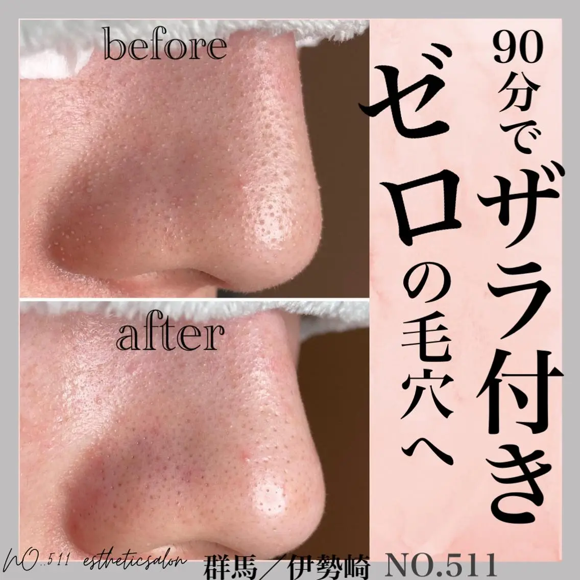 脱毛&フェイシャル NO.511のエステ・リラクイメージ