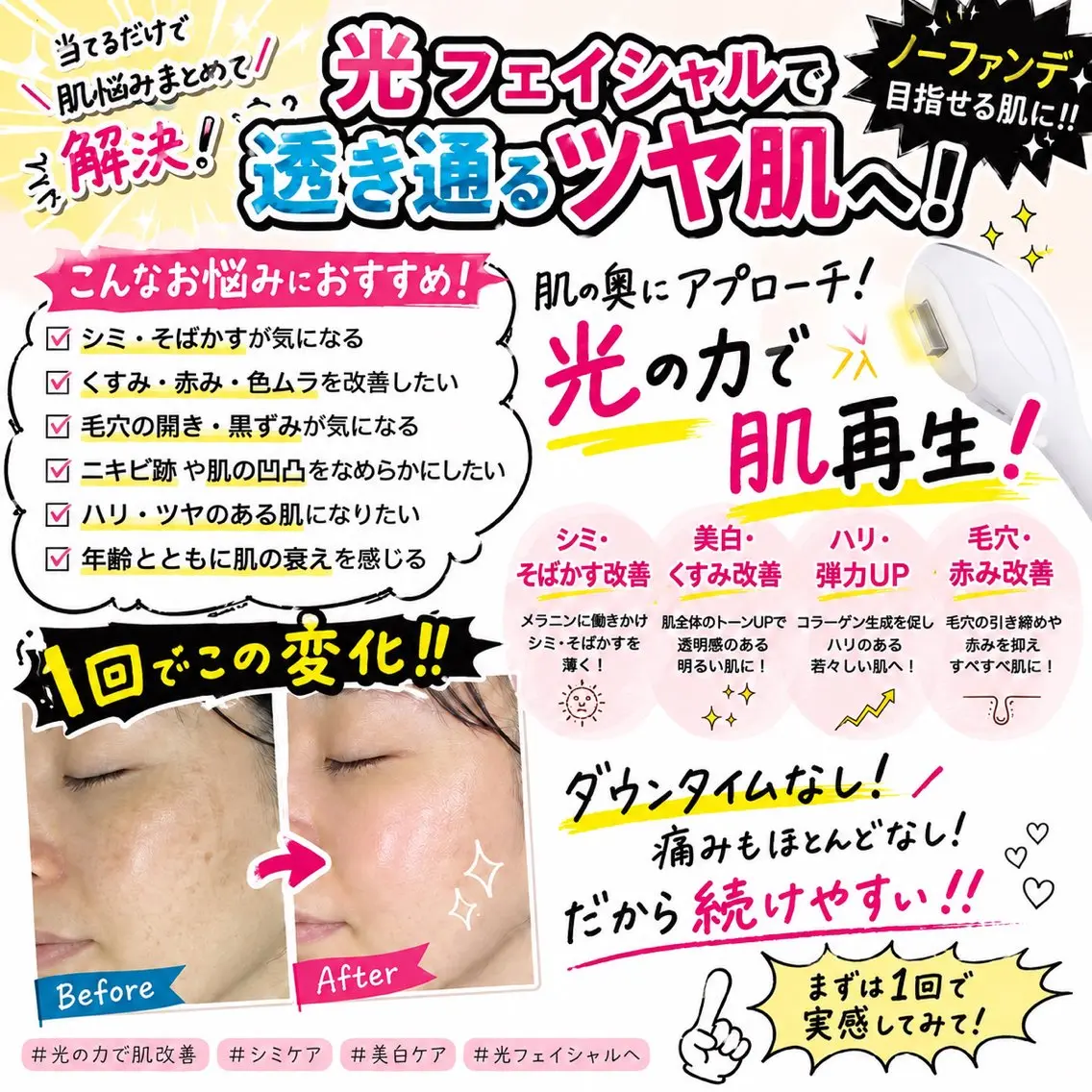 【初回】透明感あふれるシミケア可能◇光フェイシャルの写真