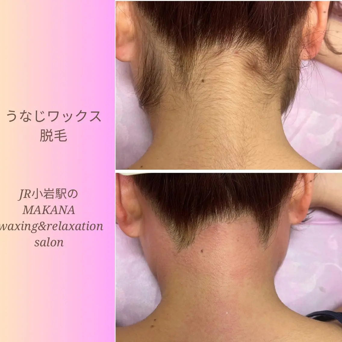 ❤️うなじWAX❤️両脇WAX❤️ヒップWAX❤️へそ下各3000円✨保湿仕上げクリーム付き🩵の写真