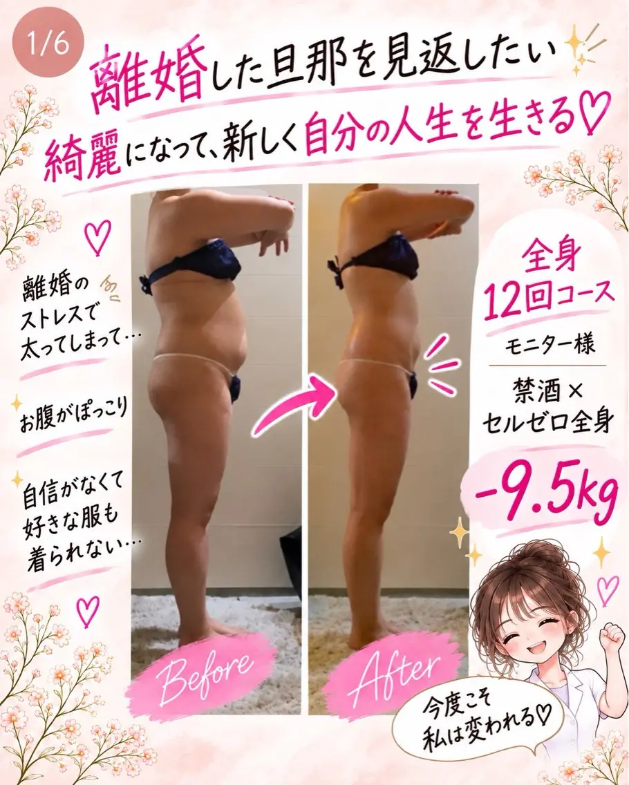 エステ 切らない脂肪吸引🔥 Neroliまりこのエステ・リラクイメージ