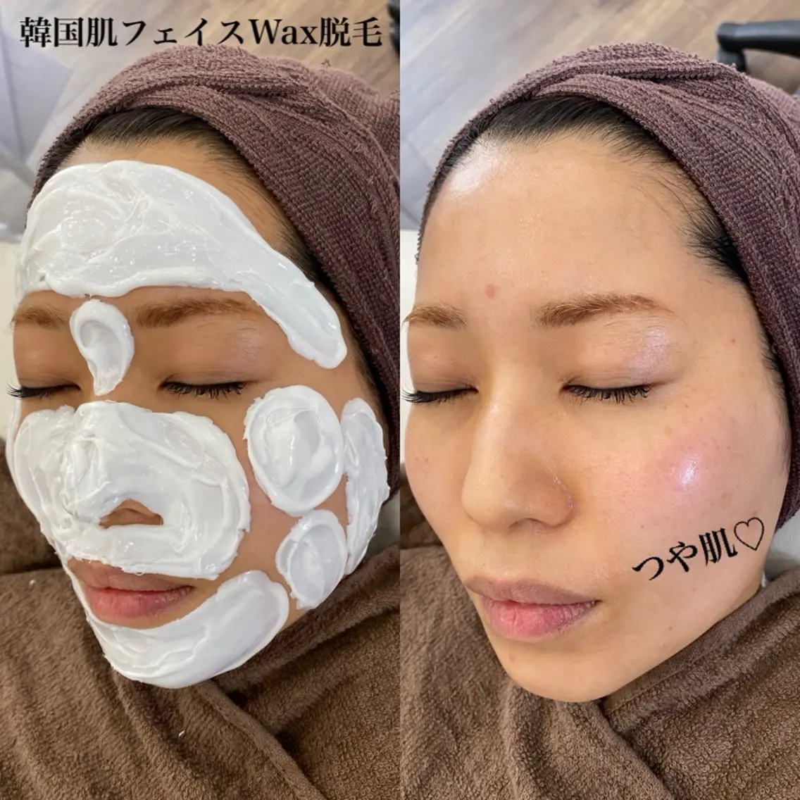 最新‼️韓国肌フェイスWax脱毛❤️高保湿パック付き✨の写真