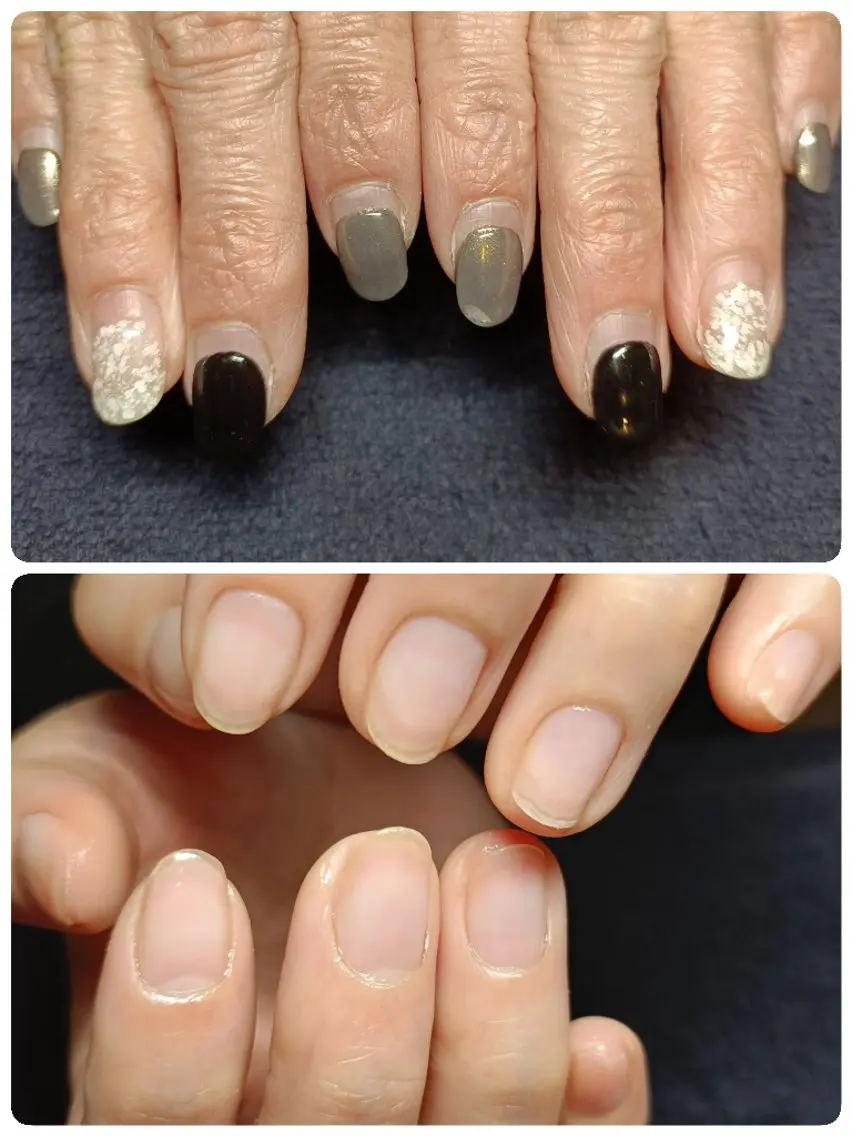 ネイル ジェルネイル オフのみ(ネイル) 深爪矯正/爪育成ケア manie nailのネイルデザイン