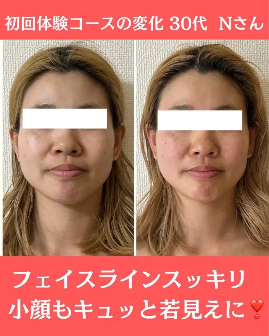 小顔サロン (ラ リュミエール)のエステ・リラクイメージ