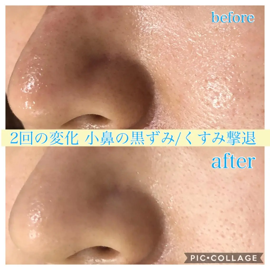 ロング カラー パーマ ヘアアレンジ キッズ ネイル マツエク・マツパ エステ リラク EnsorClair 代表 野口真央のエステ・リラクイメージ