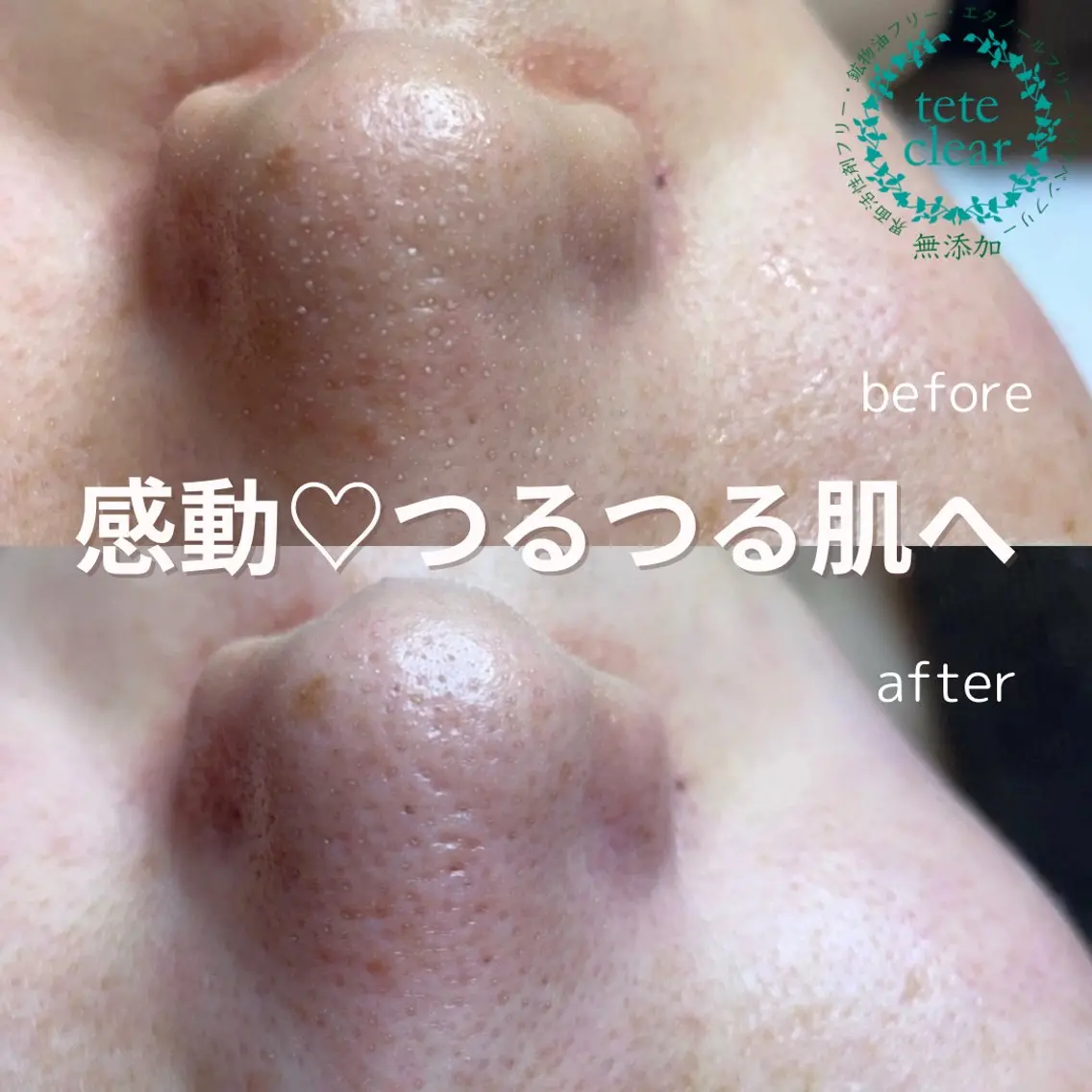 and R 男女 脱毛、毛穴サロンのエステ・リラクイメージ