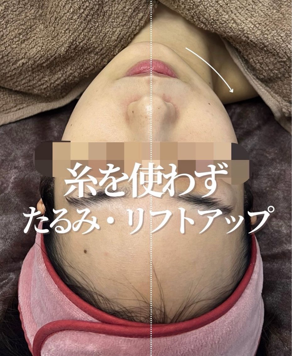 エステ 🎀看護師による 🇰🇷韓国肌管理のエステ・リラクイメージ