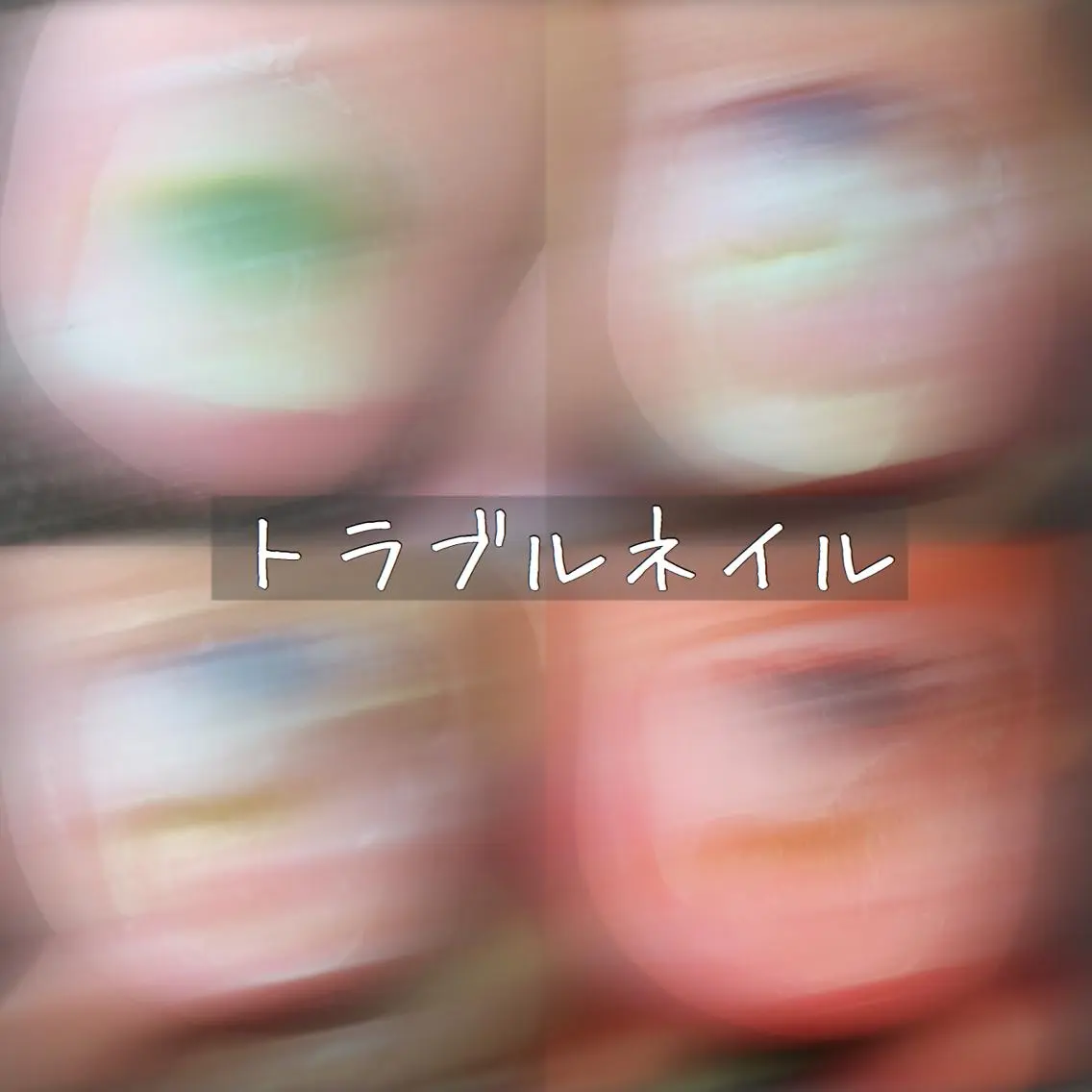 トラブルネイルケア(1本)の写真