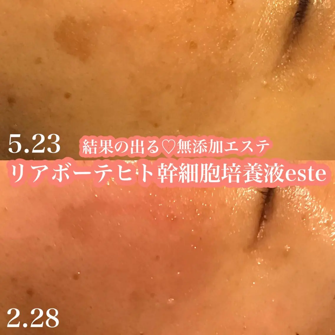 エステ 浜野 恵美のエステ・リラクイメージ