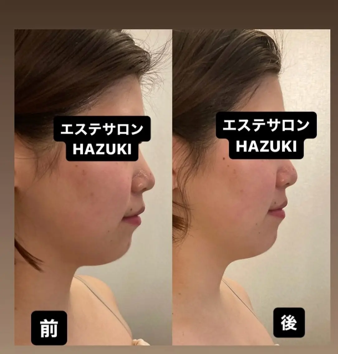 その他 たるみ改善小顔エステ 堀葉月のその他イメージ