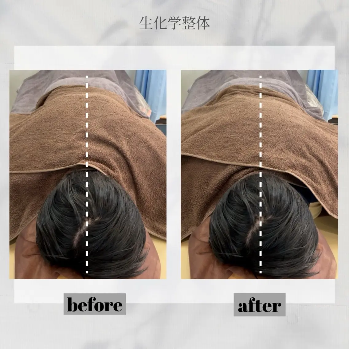 【本気の体質ケア】【短期集中プログラム】  パック内容：上半身集中×2回+全身集中×1回(通常合計：44,000円相当)の写真