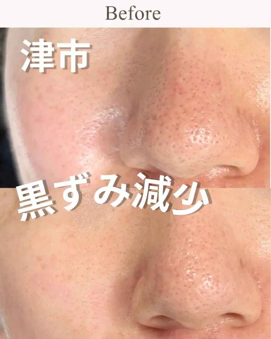 エステ Balance facialのエステ・リラクイメージ