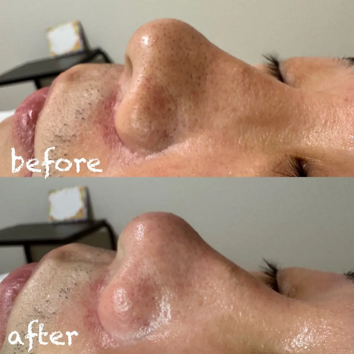 眉も小鼻も同時に綺麗に‼️ハリウッドブロウリフト+鼻の艶肌wax(箇所変更可能)の写真